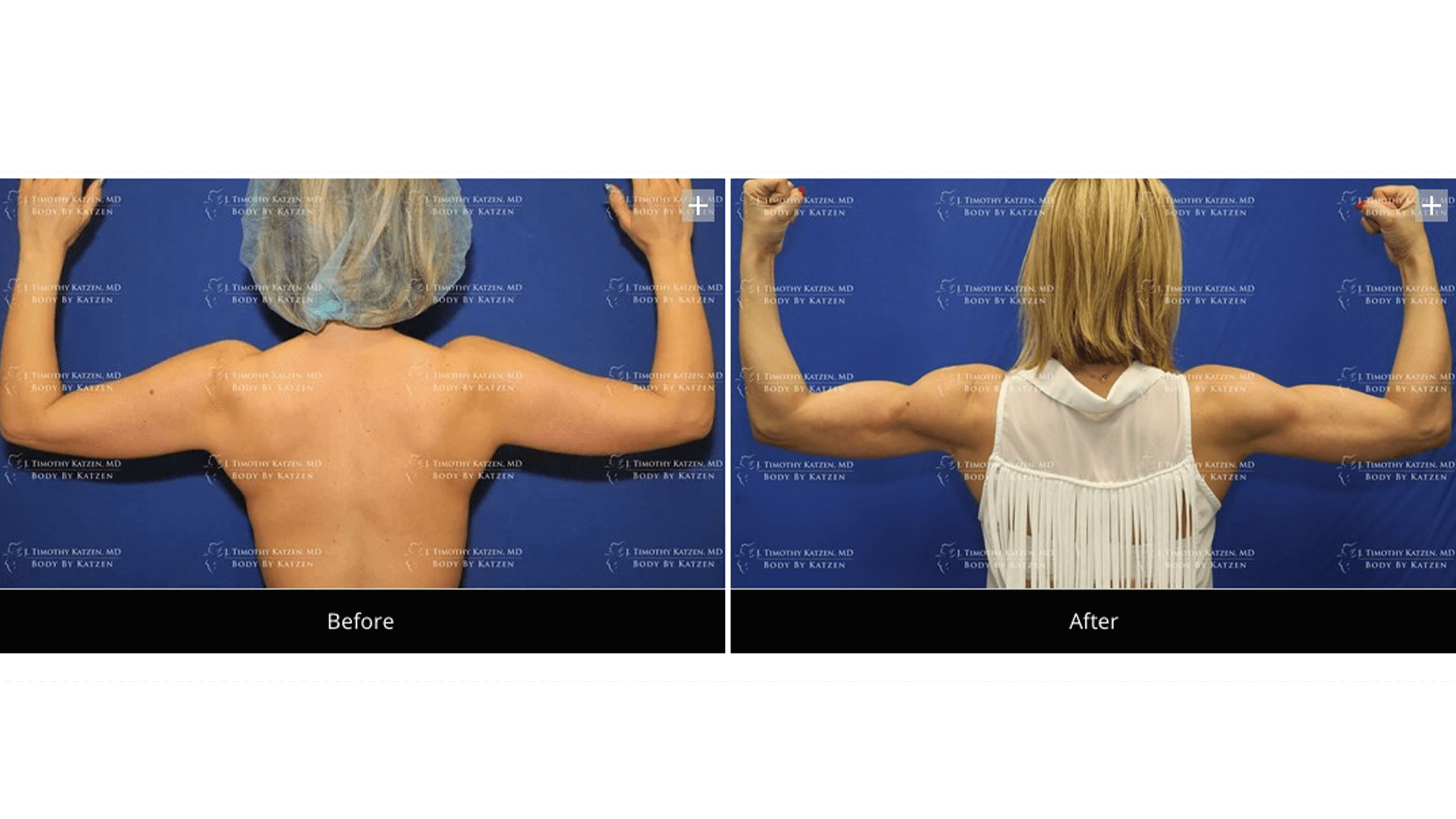 before/after